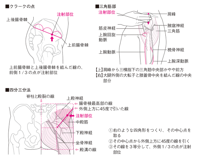 飲み忘れた場合はどうすればよいですか?